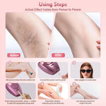 Poupette™️ Electric IPL Laser Hair Removal Device